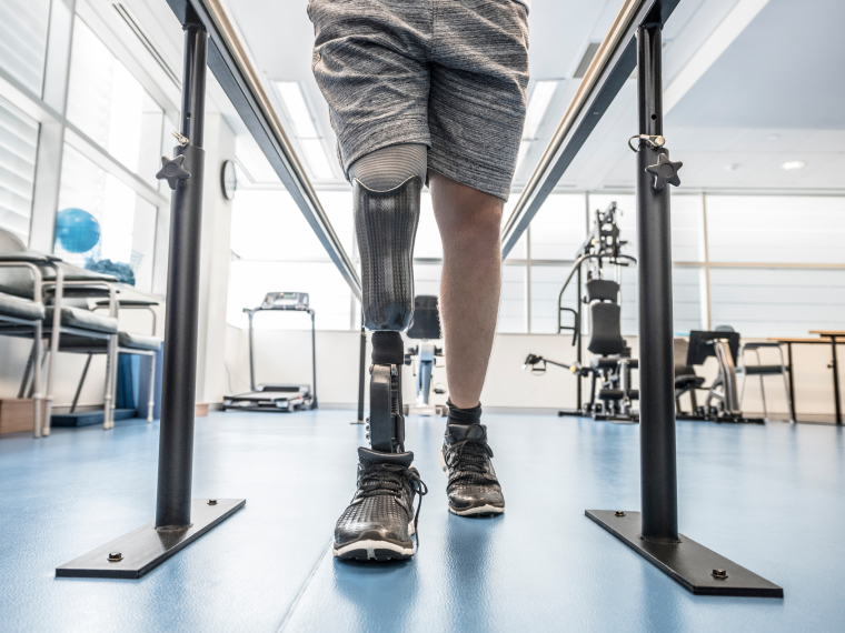lower limb prosthetics in Dubai
