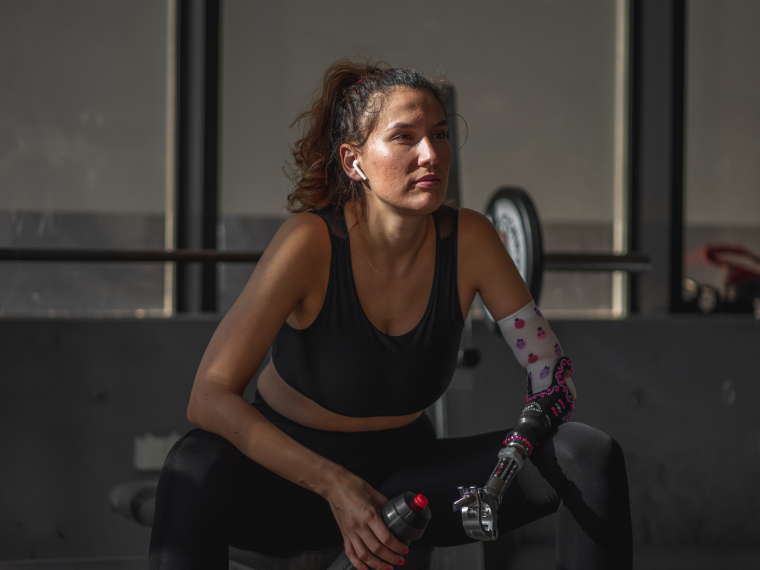 upper limb prosthetic in dubai