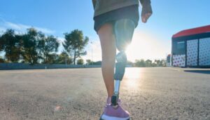 Different Types of Prosthetics